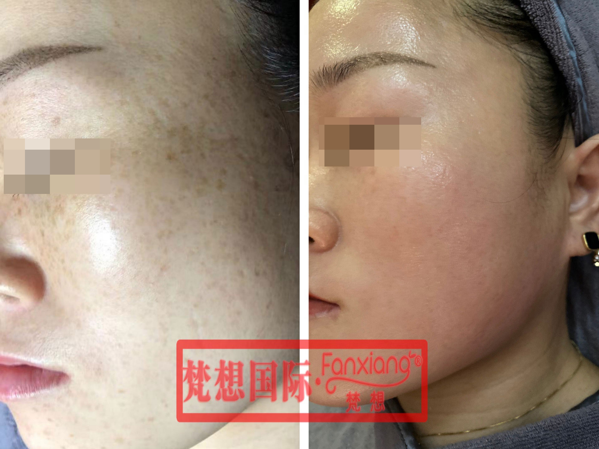 斑类案例